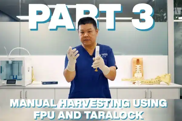 24K FAT GRAFTING SYSTEM and ADINIZER: Part 3 - Manual Harvesting Using FPU and Taralock