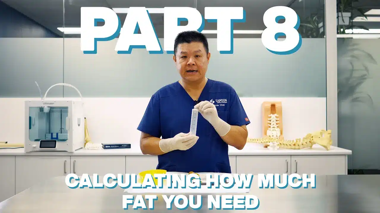 24K FAT GRAFTING SYSTEM and ADINIZER: Part 8 – Calculating How Much Fat You Need